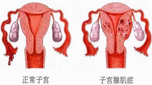 南京代怀有多少钱 目前南京哪里可以做试管婴儿? ‘看nt图看男女准吗’