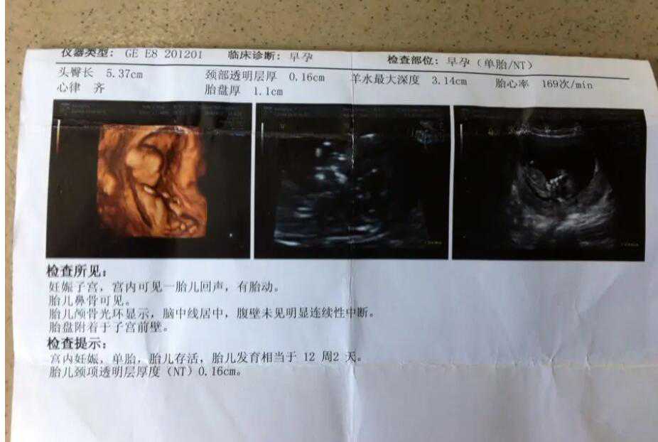 寻代孕妈犸妈妈_有代孕吗哪里咨询_湖北武汉三代试管婴儿的费用明细
