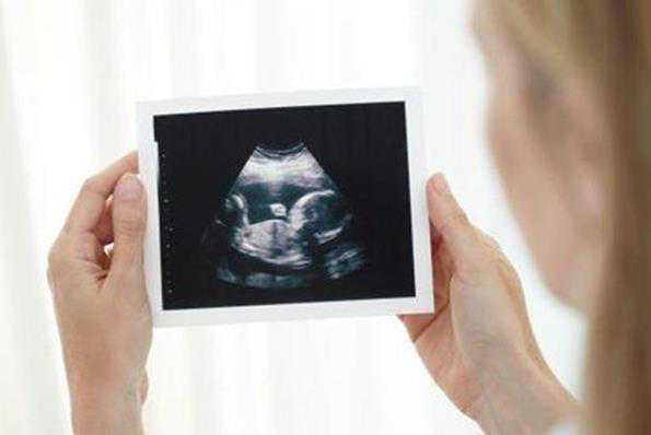 江西代生成本 胎儿四维成像超声检查江西省妇幼保健院引进美国通用电气公司